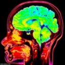 Dennis Smile Asi Fartech - Placebo Effect