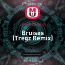 Lewis Capaldi - Bruises